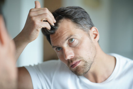 Perte de cheveux chez les hommes